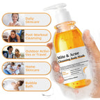 Mite & acne cleansing body wash