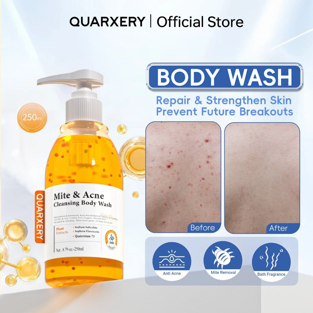 Mite & acne cleansing body wash